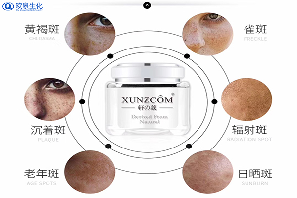 如何有效祛斑？祛斑的關(guān)鍵是什么-歐泉生化